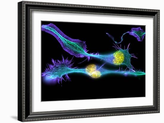 Nerve Cancer Cells, Light Micrograph-Dr. Torsten Wittmann-Framed Photographic Print