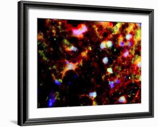 Nerve Cell Trauma Response-Riccardo Cassiani-ingoni-Framed Photographic Print