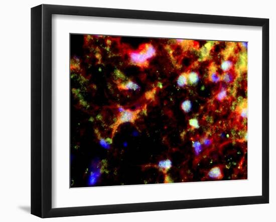 Nerve Cell Trauma Response-Riccardo Cassiani-ingoni-Framed Photographic Print