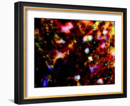 Nerve Cell Trauma Response-Riccardo Cassiani-ingoni-Framed Photographic Print