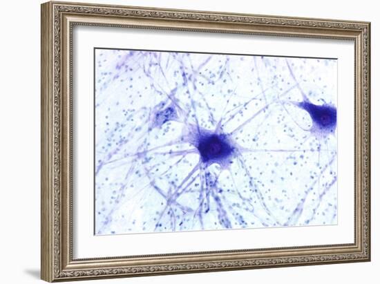 Nerve Cells, Light Micrograph-Steve Gschmeissner-Framed Photographic Print