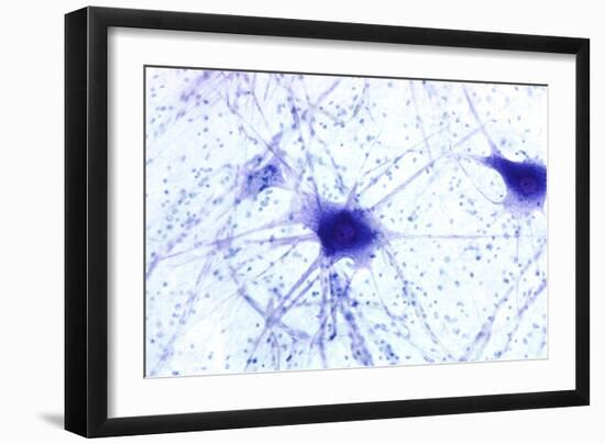 Nerve Cells, Light Micrograph-Steve Gschmeissner-Framed Photographic Print