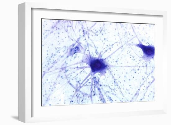 Nerve Cells, Light Micrograph-Steve Gschmeissner-Framed Photographic Print