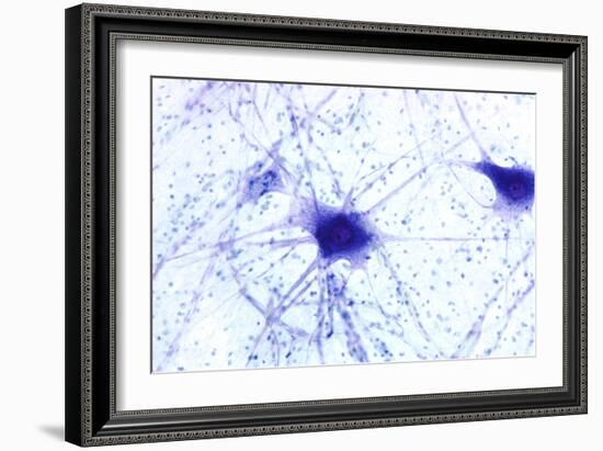 Nerve Cells, Light Micrograph-Steve Gschmeissner-Framed Photographic Print