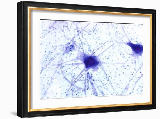 Nerve Cells, Light Micrograph-Steve Gschmeissner-Framed Photographic Print