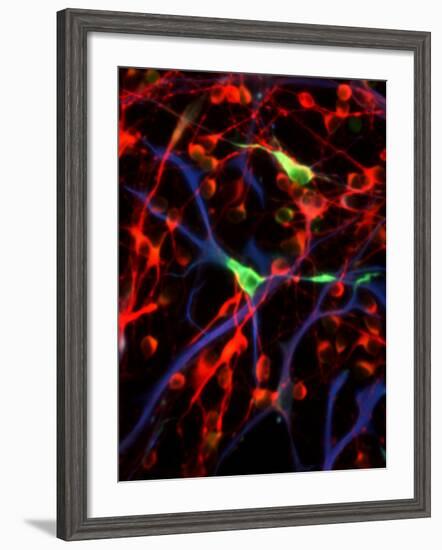 Nerve Cells-Riccardo Cassiani-ingoni-Framed Photographic Print