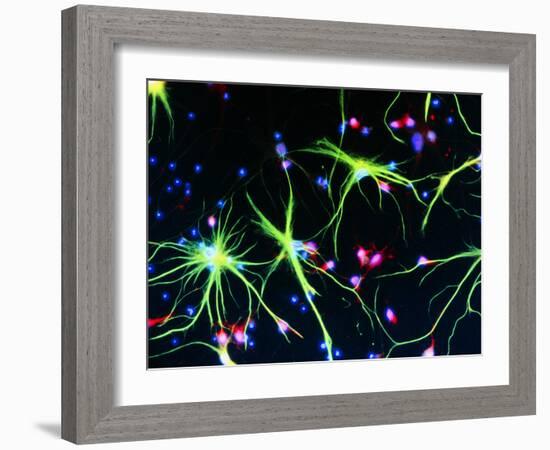 Nerve Cells-Nancy Kedersha-Framed Photographic Print