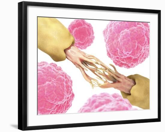 Nerve Damage And Stem Cells, Artwork-David Mack-Framed Photographic Print