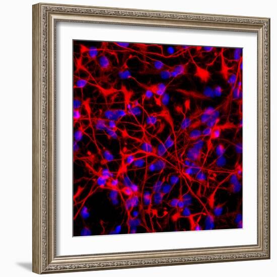 Neural Stem Cells In Culture-Riccardo Cassiani-ingoni-Framed Premium Photographic Print