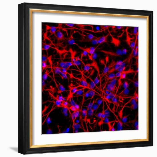 Neural Stem Cells In Culture-Riccardo Cassiani-ingoni-Framed Premium Photographic Print