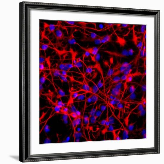 Neural Stem Cells In Culture-Riccardo Cassiani-ingoni-Framed Photographic Print