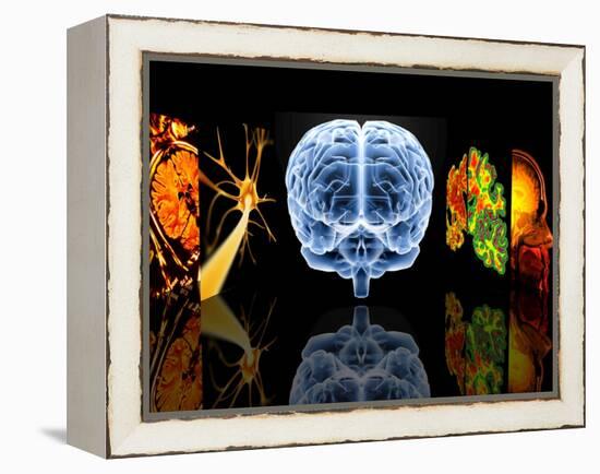 Neurology-PASIEKA-Framed Premier Image Canvas