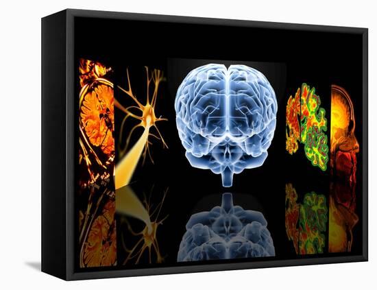 Neurology-PASIEKA-Framed Premier Image Canvas