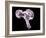 Neutrophil White Blood Cell, SEM-Science Photo Library-Framed Photographic Print