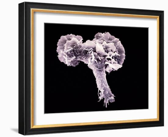 Neutrophil White Blood Cell, SEM-Science Photo Library-Framed Photographic Print