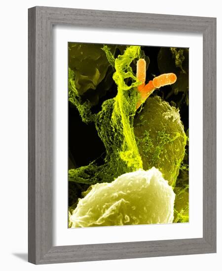 Neutrophils And Shigella Bacteria, SEM-Science Photo Library-Framed Photographic Print