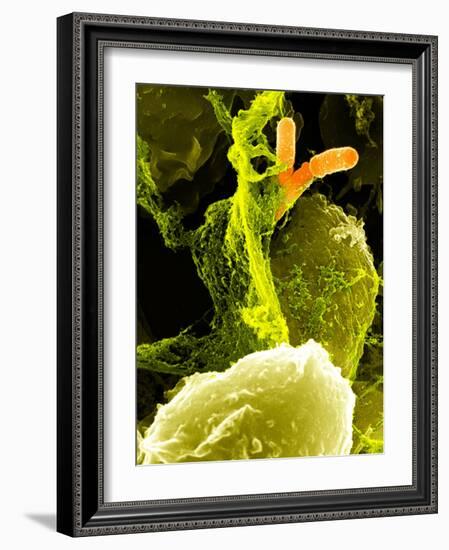 Neutrophils And Shigella Bacteria, SEM-Science Photo Library-Framed Photographic Print