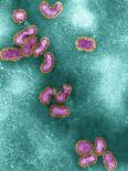 H5N1 Avian Influenza Virus Particles, TEM-NIBSC-Framed Photographic Print