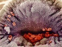 Coloured SEM of Mouth of Schistosome Parasite-NIBSC-Photographic Print