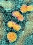 Coloured TEM of HIV Viruses Budding From a T-cell-NIBSC-Photographic Print
