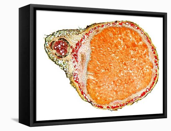 Nitrogen-fixing Root Nodule, Micrograph-Dr. Keith Wheeler-Framed Premier Image Canvas