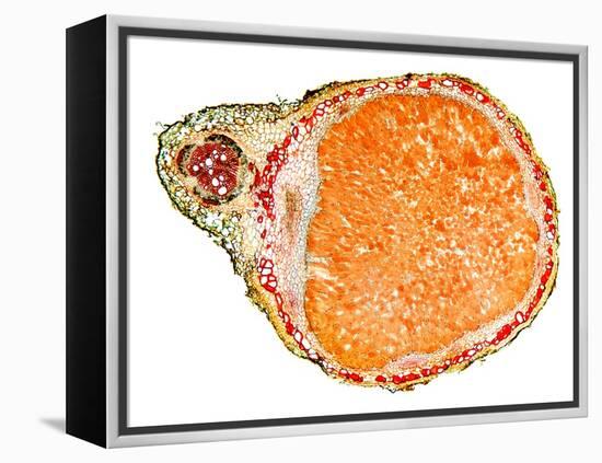 Nitrogen-fixing Root Nodule, Micrograph-Dr. Keith Wheeler-Framed Premier Image Canvas