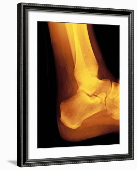 Normal Ankle Joint, X-ray-Miriam Maslo-Framed Photographic Print