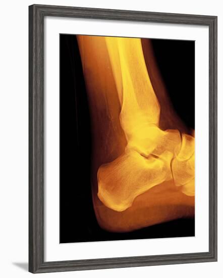 Normal Ankle Joint, X-ray-Miriam Maslo-Framed Photographic Print