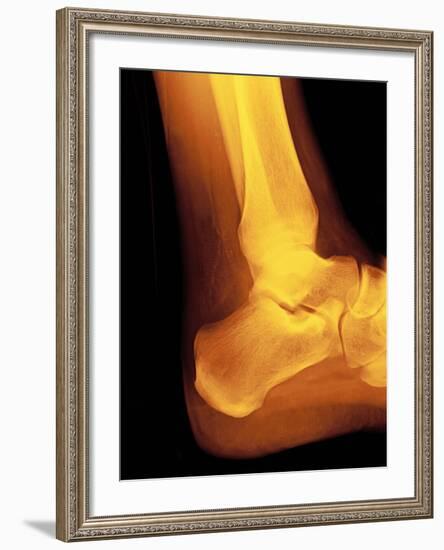 Normal Ankle Joint, X-ray-Miriam Maslo-Framed Photographic Print