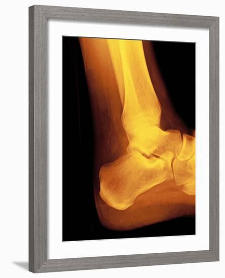 Normal Ankle Joint, X-ray-Miriam Maslo-Framed Photographic Print