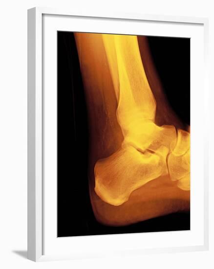 Normal Ankle Joint, X-ray-Miriam Maslo-Framed Photographic Print