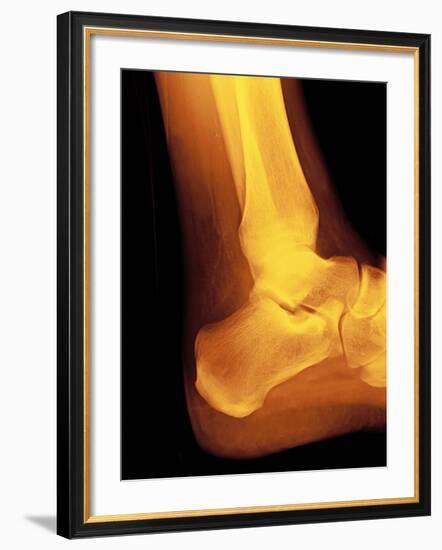 Normal Ankle Joint, X-ray-Miriam Maslo-Framed Photographic Print