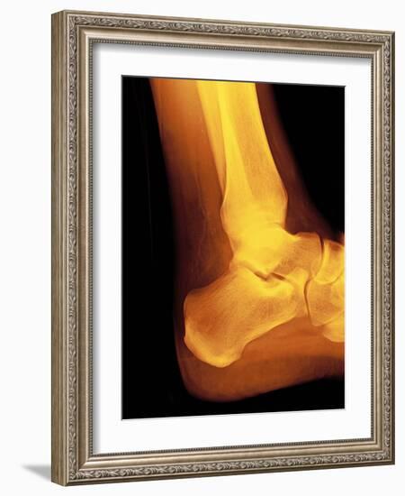 Normal Ankle Joint, X-ray-Miriam Maslo-Framed Photographic Print