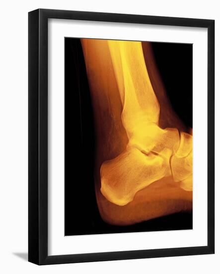 Normal Ankle Joint, X-ray-Miriam Maslo-Framed Photographic Print