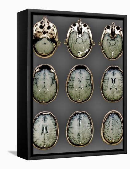 Normal Brain, MRI Scans-ZEPHYR-Framed Premier Image Canvas