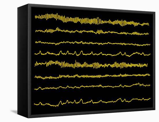 Normal EEG Read Out of the Brains Alpha Waves-Science Photo Library-Framed Premier Image Canvas