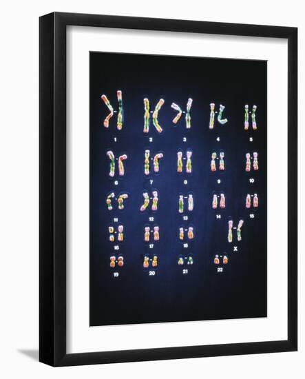 Normal Female Chromosomes-null-Framed Photographic Print