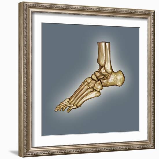 Normal Foot, 3D CT Scan-ZEPHYR-Framed Premium Photographic Print