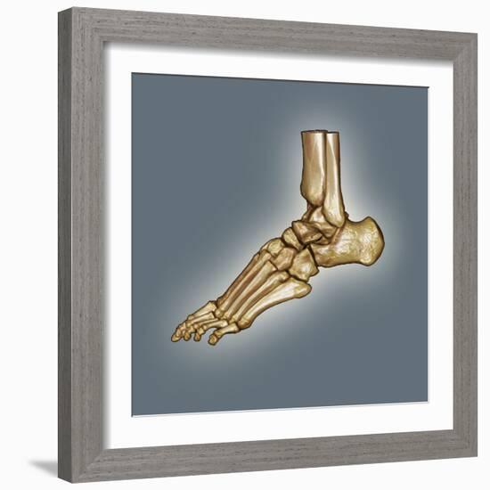 Normal Foot, 3D CT Scan-ZEPHYR-Framed Premium Photographic Print