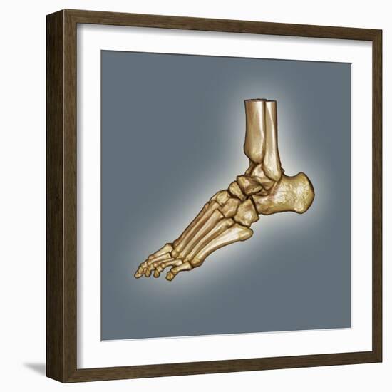 Normal Foot, 3D CT Scan-ZEPHYR-Framed Premium Photographic Print