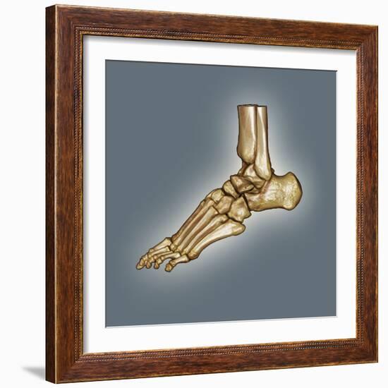 Normal Foot, 3D CT Scan-ZEPHYR-Framed Premium Photographic Print