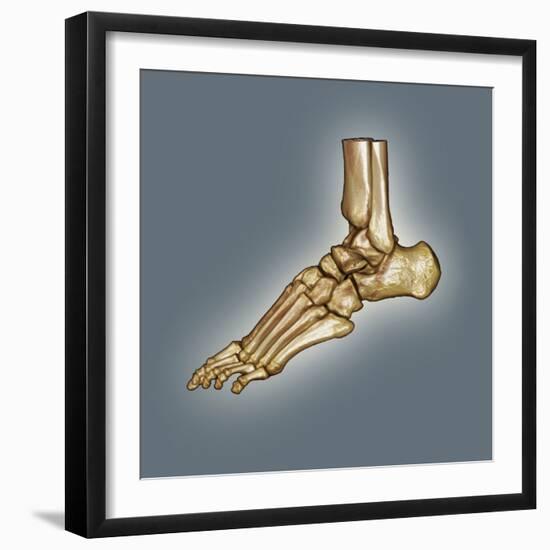 Normal Foot, 3D CT Scan-ZEPHYR-Framed Premium Photographic Print