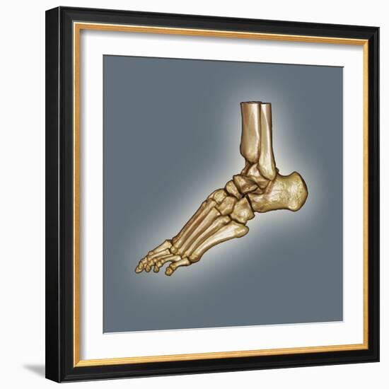 Normal Foot, 3D CT Scan-ZEPHYR-Framed Premium Photographic Print