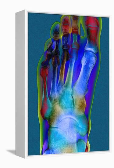 Normal Foot, X-ray-Du Cane Medical-Framed Premier Image Canvas