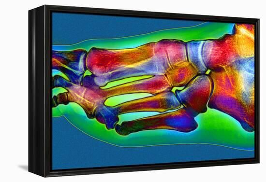 Normal Foot, X-ray-Du Cane Medical-Framed Premier Image Canvas