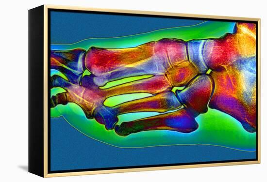 Normal Foot, X-ray-Du Cane Medical-Framed Premier Image Canvas