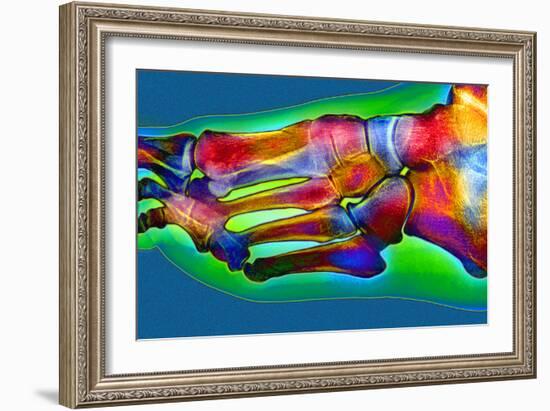 Normal Foot, X-ray-Du Cane Medical-Framed Photographic Print