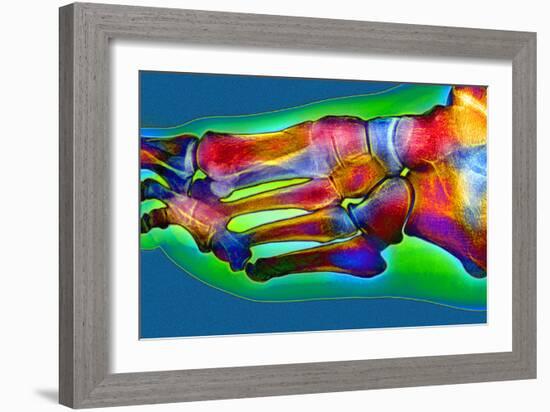 Normal Foot, X-ray-Du Cane Medical-Framed Photographic Print