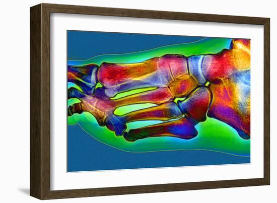 Normal Foot, X-ray-Du Cane Medical-Framed Photographic Print