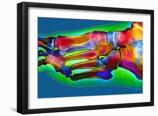 Normal Foot, X-ray-Du Cane Medical-Framed Photographic Print